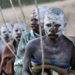 The Xhosa Male Circumcision Tradition in South Africa: Balancing Cultural Heritage and Health Risks